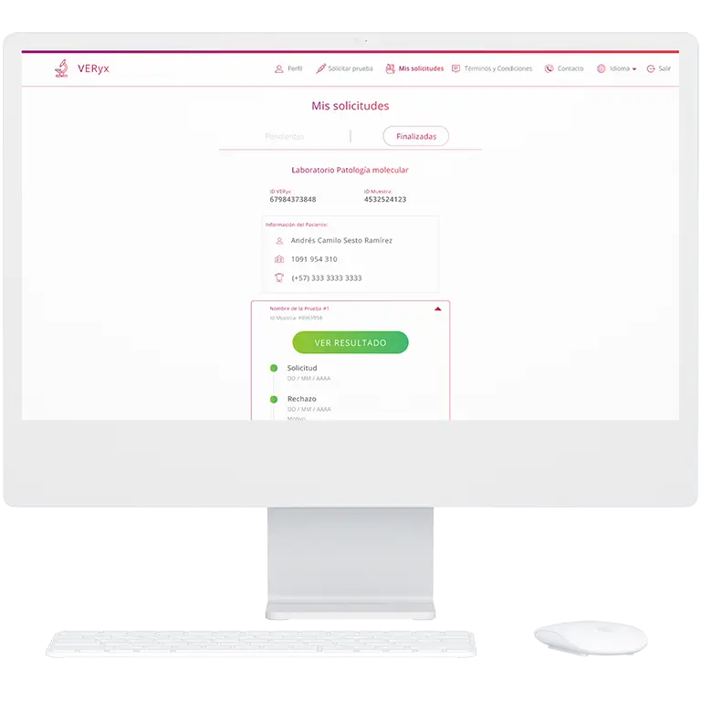 Development methodology, QA, and Testing - VERyx